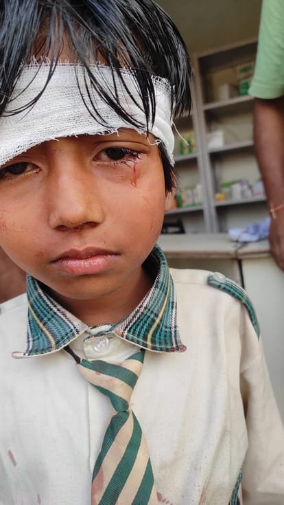 Varanasi: Vikram auto full of children collided with a tree, people came hearing the screams, many children w