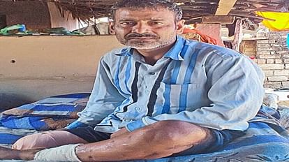 Morena News: हादसे का दर्द झेल रहे बृजेंद्र का परिवार दाने-दाने को मोहताज, पढ़ाई-लिखाई और दवाई के लिए चिंतित Morena News Bijender Sikarwar family is facing financial crisis due to road accident