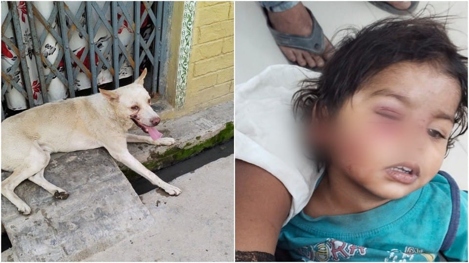 two-year-old girl was attacked by a dog in Nagla Revati AGRA