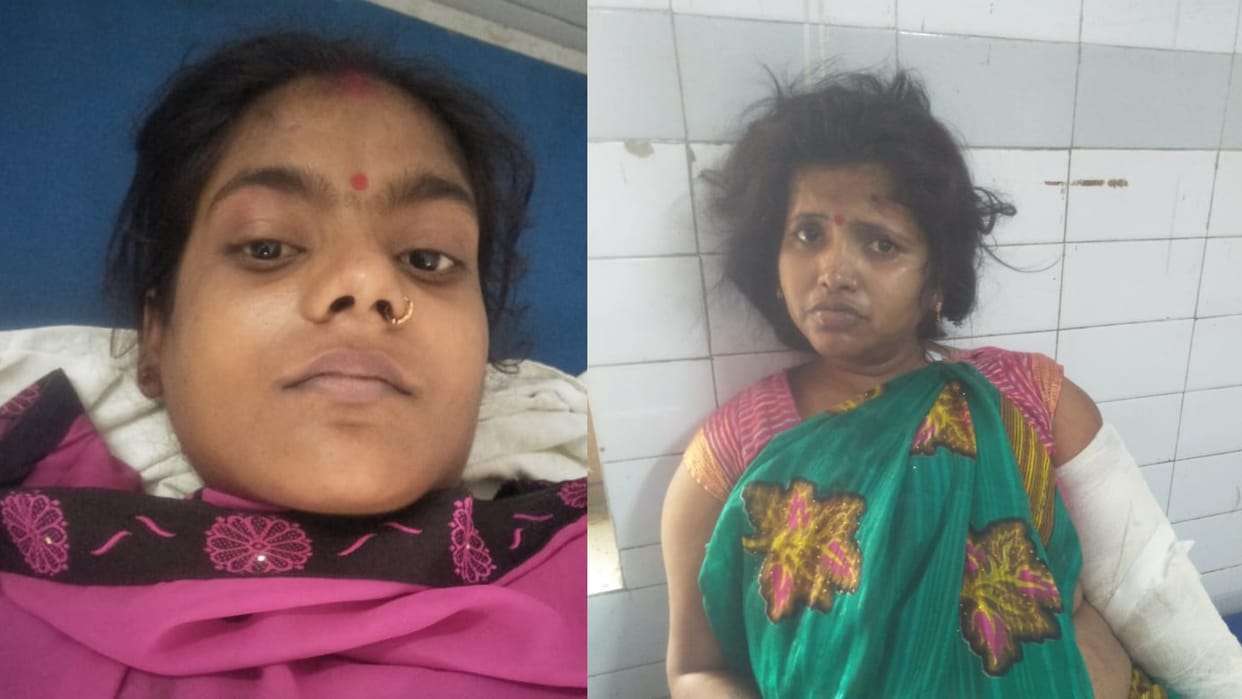 Victims of Shravasti accident speaks about accident.