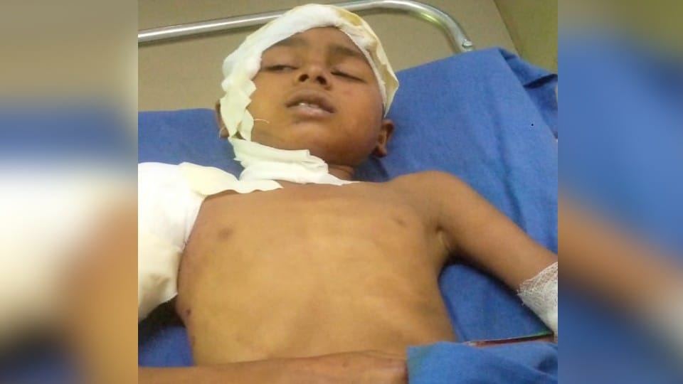 Stray Dogs attacks on ten year old boy in CBganj bareilly