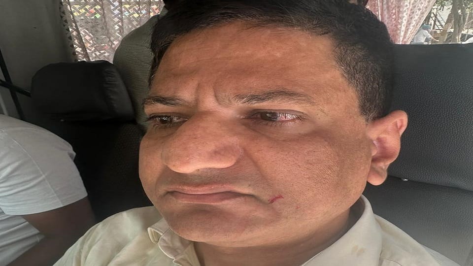 Delhi: Constable beat visually impaired SDM and team hostage