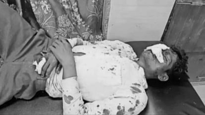 MP News: सागर के मजदूर को दमोह रेलवे स्टेशन से उठाकर ले गए बदमाश, लूटने के बाद मरणासन्न हालत में सड़क पर फेंका The miscreants took Sagar's laborer from Damoh railway station, after robbing, threw him on the road