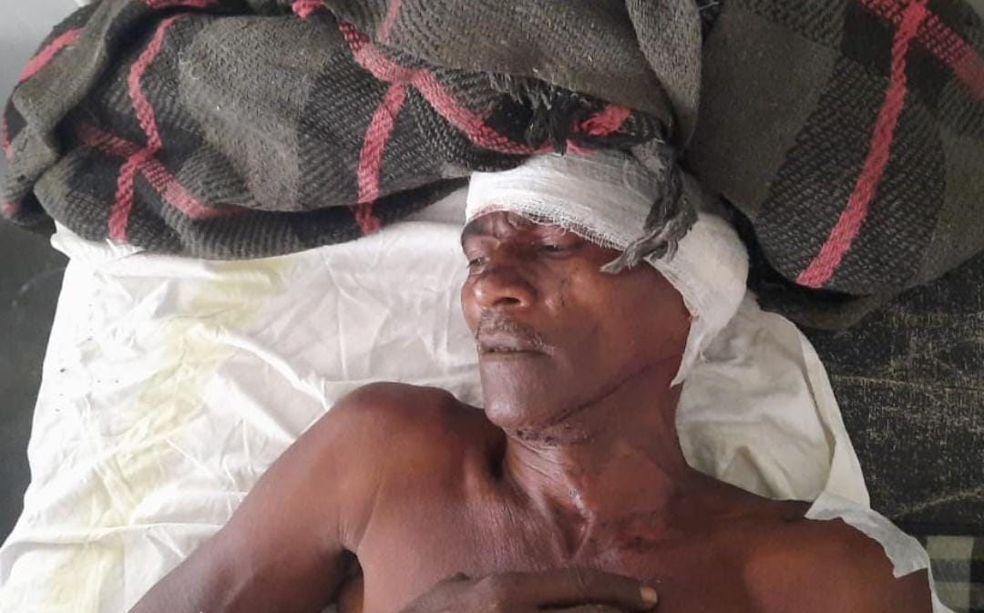 MP News: When pets reached brother's farm, he attacked, old man's ear cut off