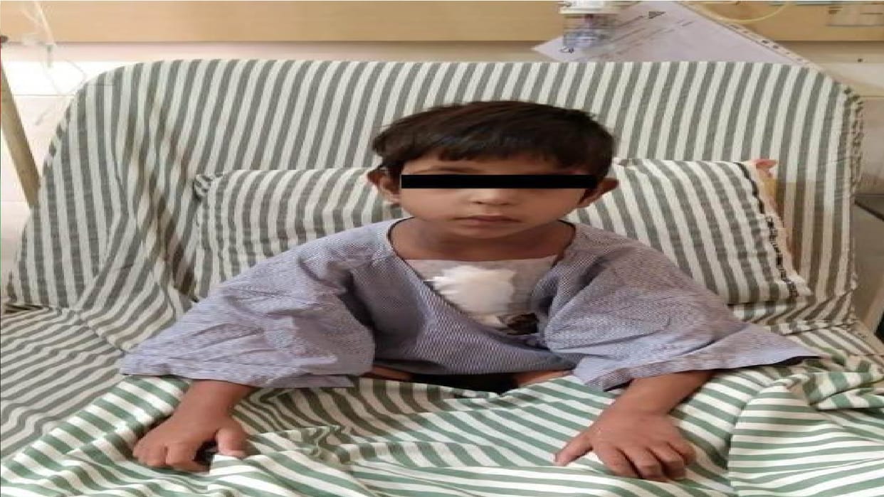 Bhavesh hole in his heart, free operation was done under Chirayu scheme in raipur