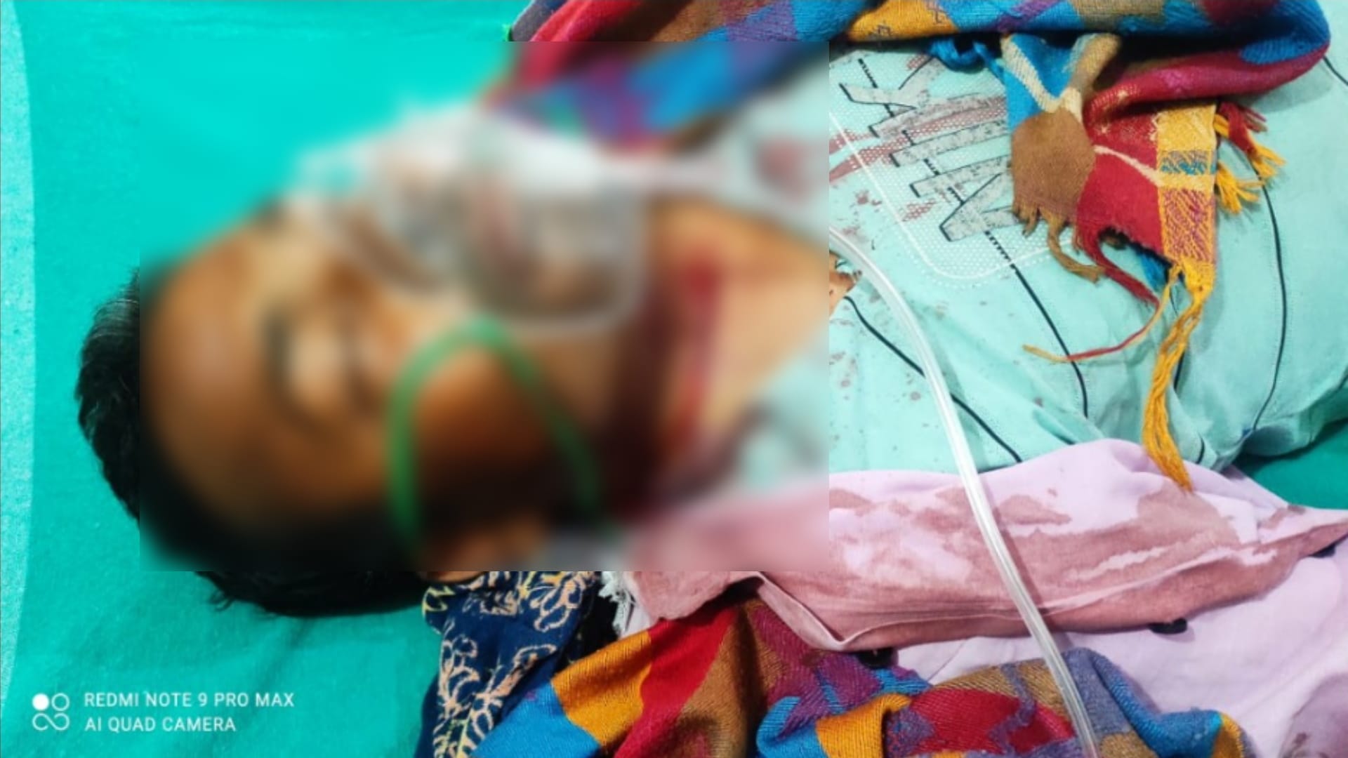 Bijnor: Woman clashed with henchman to save her husband, farmer was killed yesterday