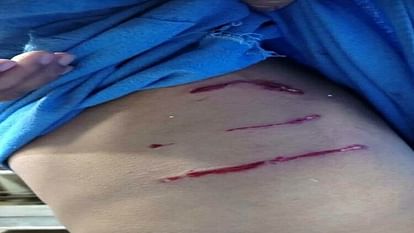 AMU: शोधार्थी पर कुत्तों के झुंड ने किया हमला, कॉमन रूम की तरफ भागकर बचाई जान AMU Researcher attacked by a pack of dogs