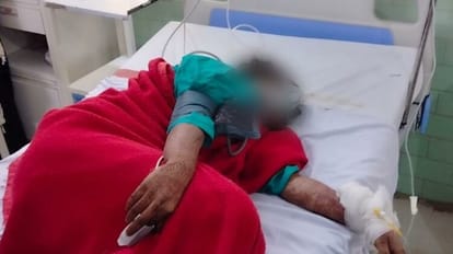 Father tried to kill daughter by acid attack in bareilly