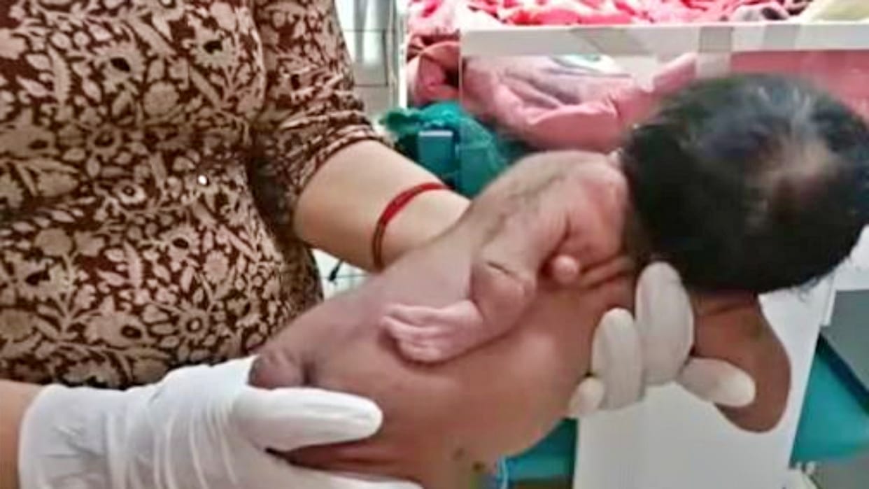 Rajasthan Unique child with Three hands born in Hanumangarh
