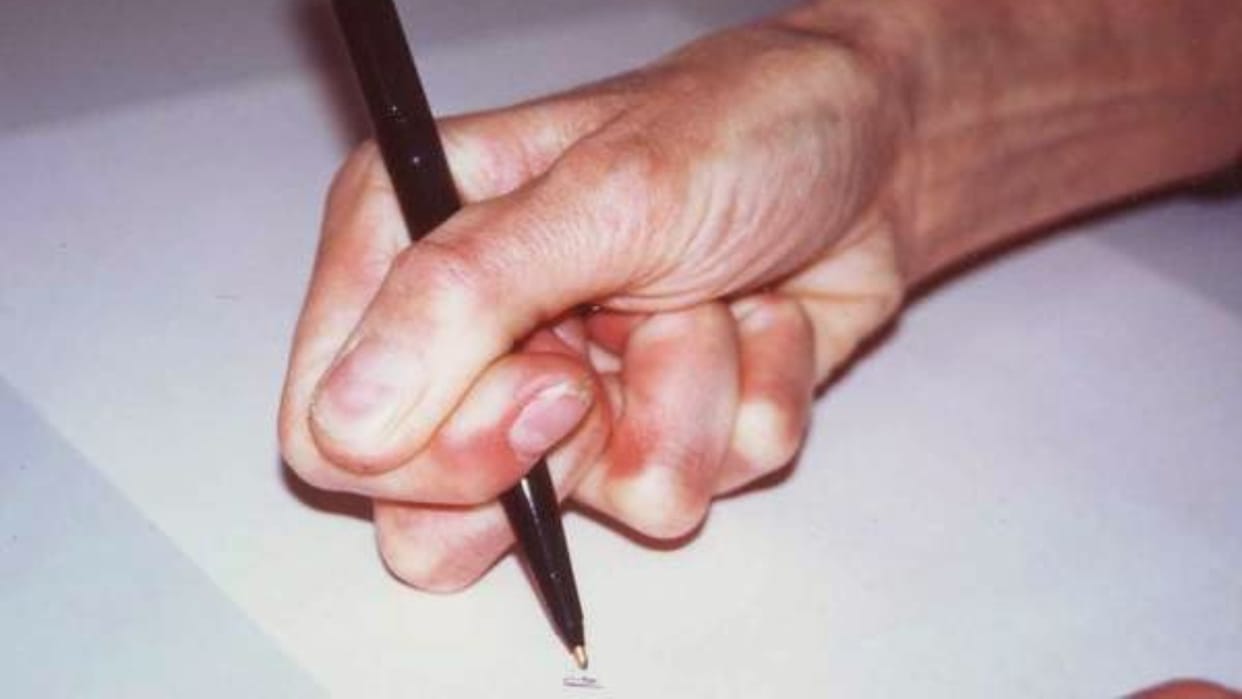 Verdict: SC allows judicial services aspirant suffering from writer's cramp to use writer