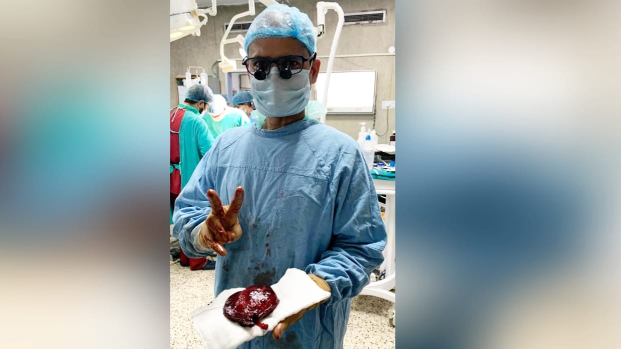 liver tumor surgery by doctors team in IGMC Hospital Shimla