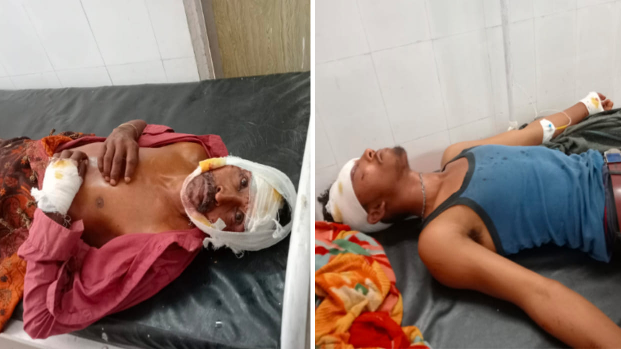 MP News: A bus full of baraatis overturned uncontrolled in Deori valley, five serious among 45 injured