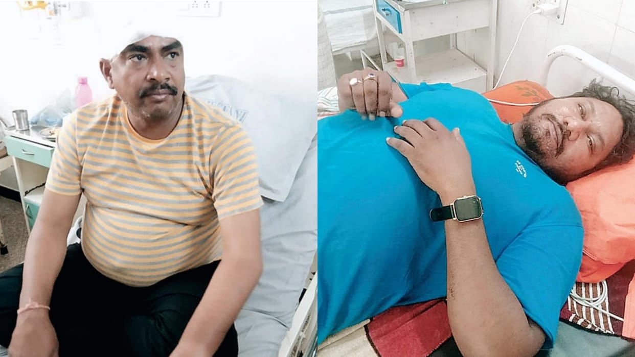 Ujjain News Two BJP leaders clashed in the rivalry of corporation elections both injured