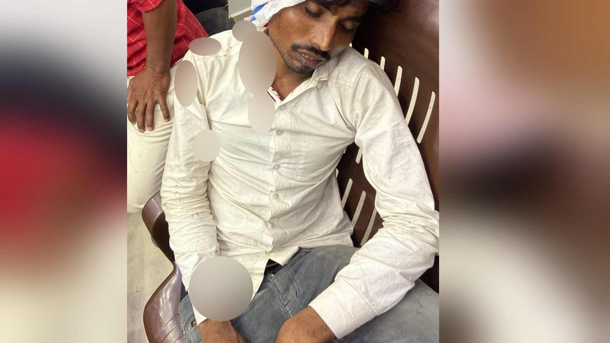 Ruckus between supporters of BJP and independent candidates in Ganeshpur of Basti