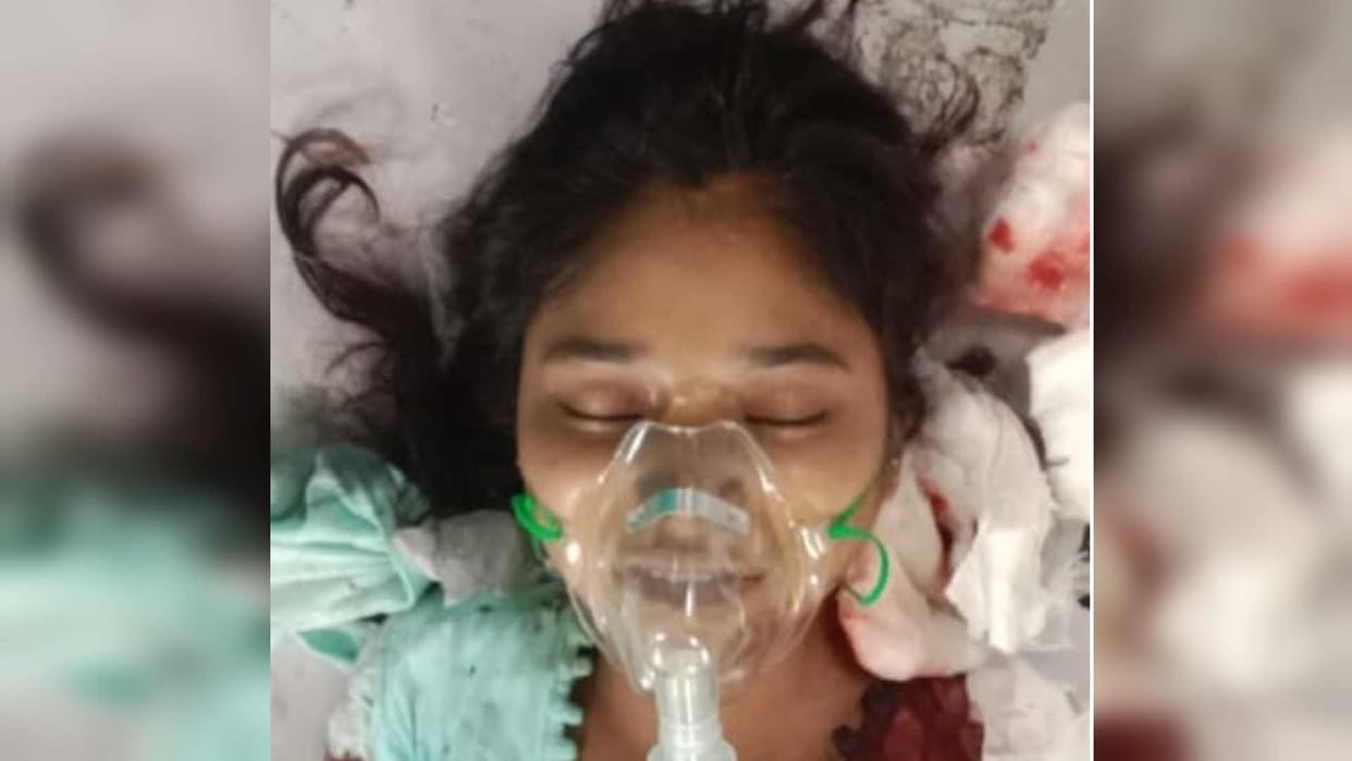 girl attacked by banka for refusing to marry in Gorakhpur