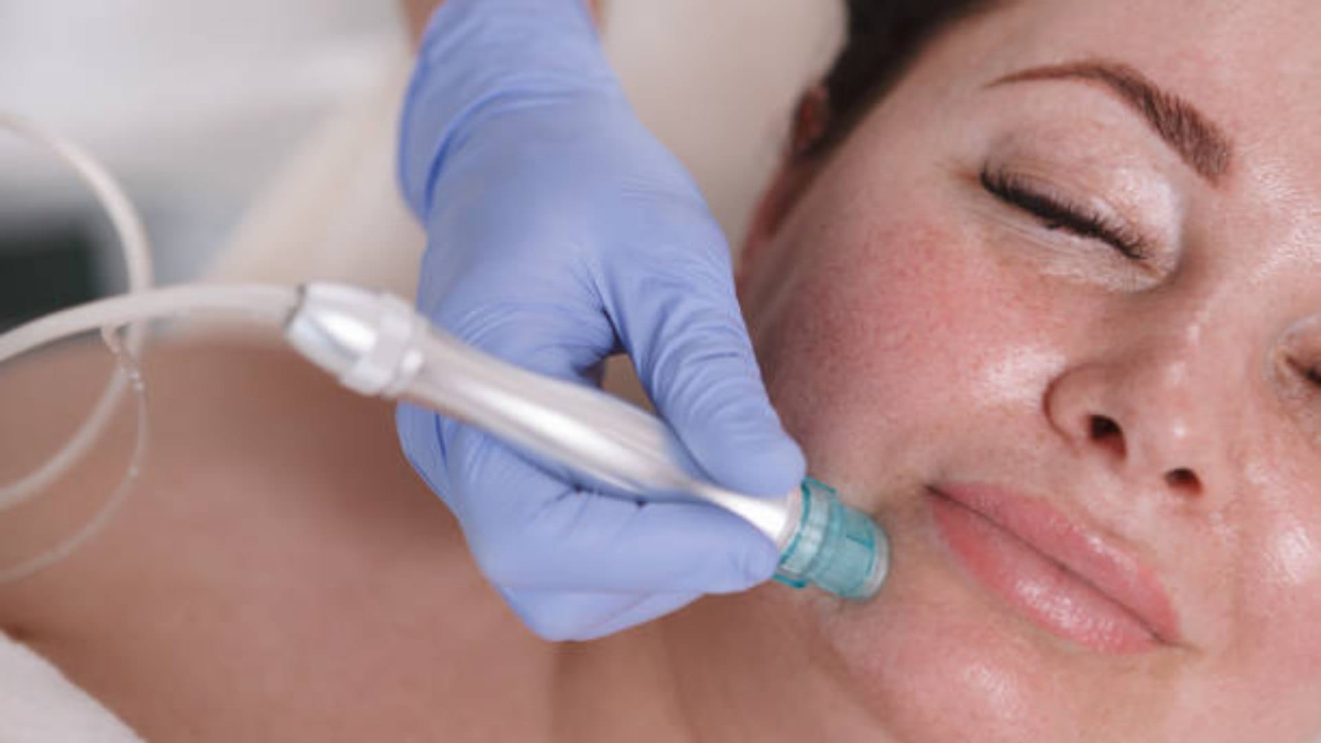 What Is a HydraFacial How It Works Benefits and Risks in hindi