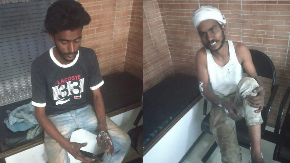 Five laborers injured in accident in furnace unit located in Mandi Gobindgarh