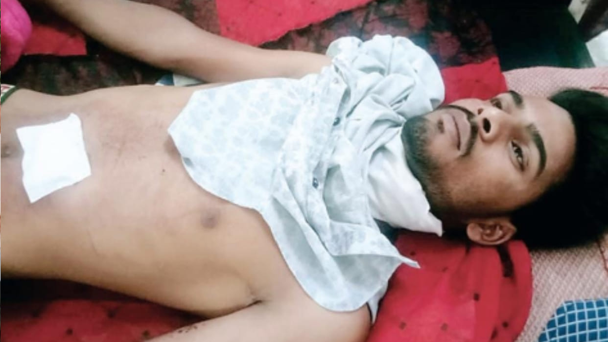Four miscreants stopped the couple and fled by hitting them with a blade