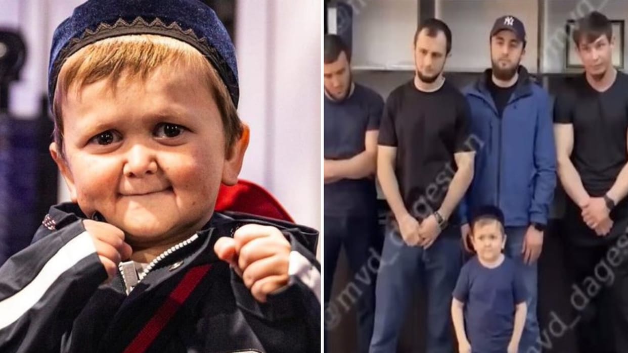 Social Media Star Hasbulla ARRESTED In Dagestan For Violating Traffic Laws
