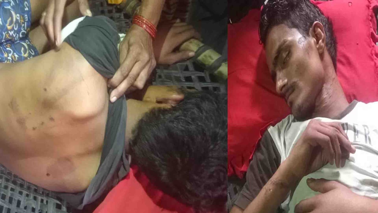 Shuklaganj: Police beat up youth in Kotwali