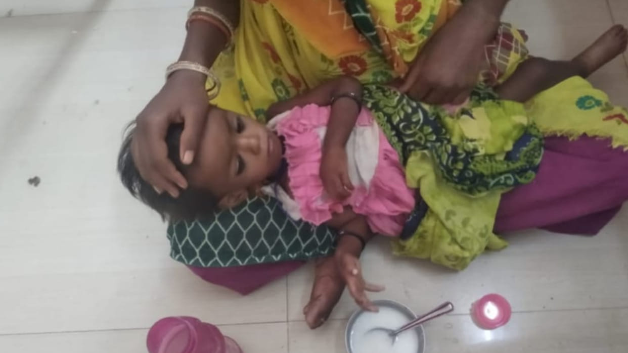 Damoh News: Human Rights Commission seeks answer in the case of death of tribal girl due to malnutrition