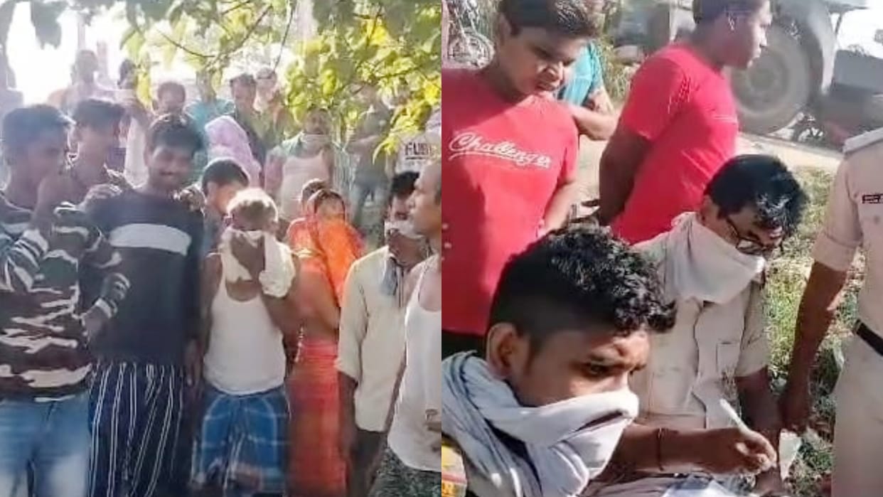 Samastipur Crime Sensation after finding half-dead body of girl suspicion of acid being poured on body