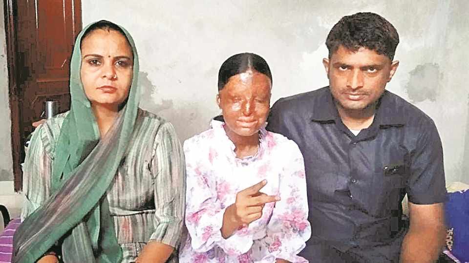 Acid attack victim topped in school in CBSE 10th exam in Chandigarh