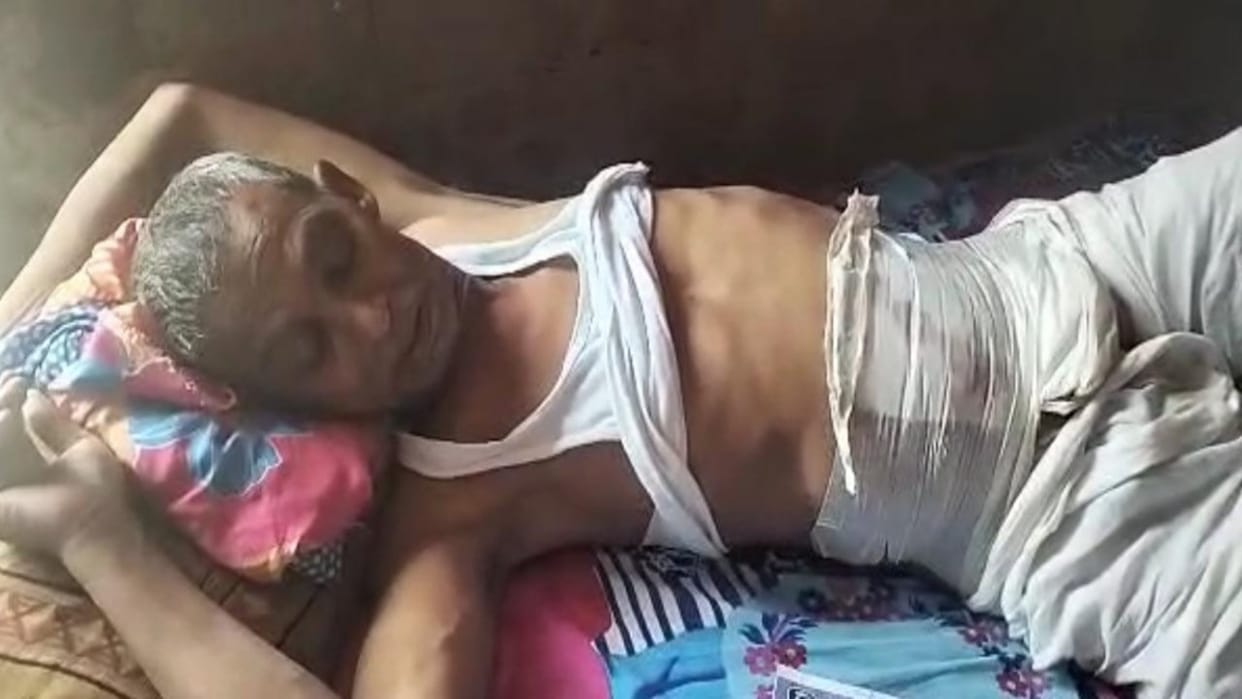 Hydrocele cut after kidney and urine tube in name of hernia operation in Muzaffarpur