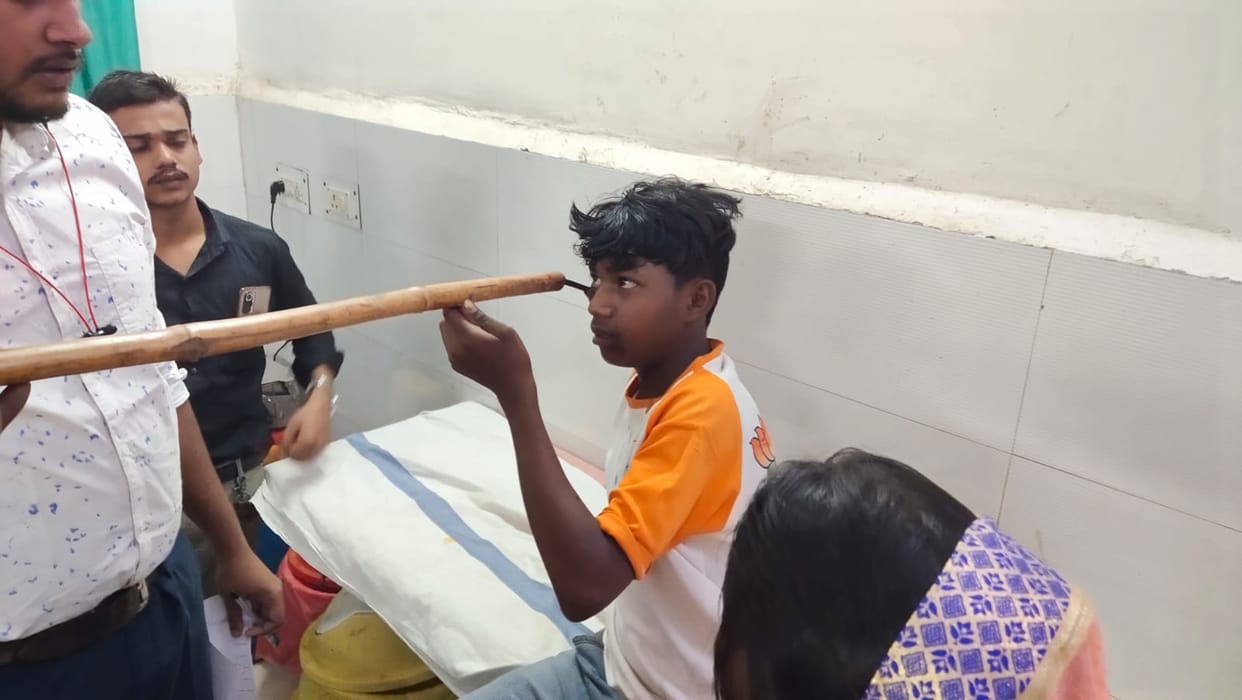 10 year old travelled 50 km carrying iron rod in eye, Shahdol news updates