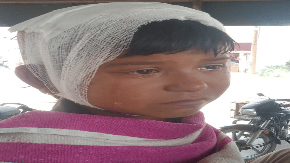 A girl student injured due to falling plaster of the roof of Dahana Primary School