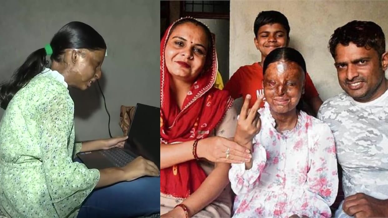 CBSE 10th Class 2023 Topper Kafi Acid Attack Survivor Read Struggle to Success Full Story