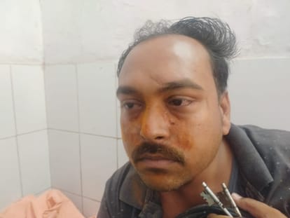 Fatehpur Saraf robbery, fearless novice crook captured in CCTV, police have formed five teams