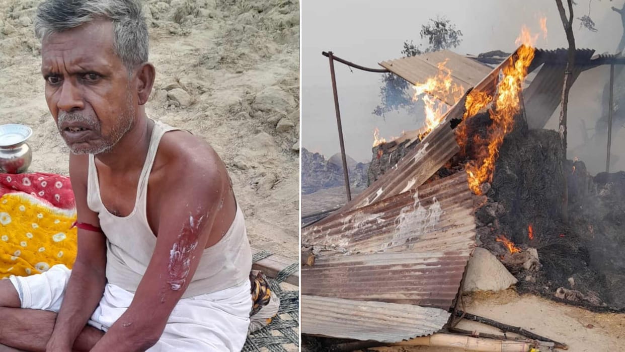 Huts caught fire due to cigarettes one scorched in Gorakhpur