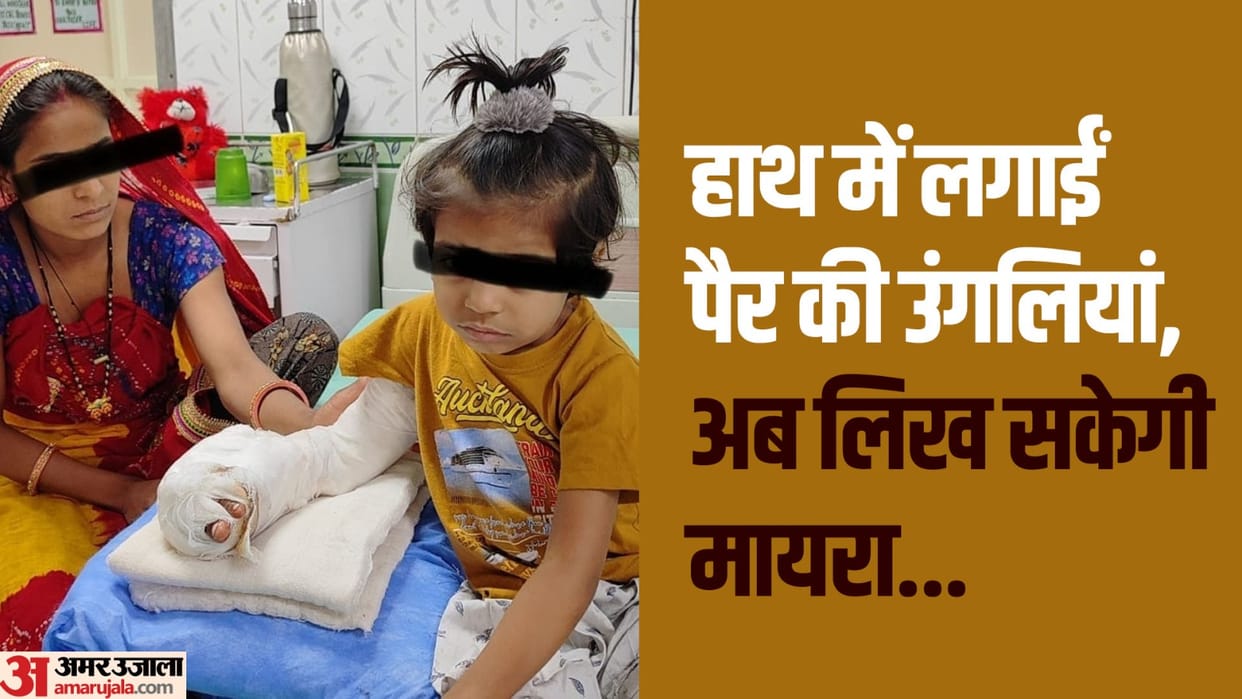 Doctors of Safdarjung did successful surgery  two year old girl fingers cut while cutting fodder
