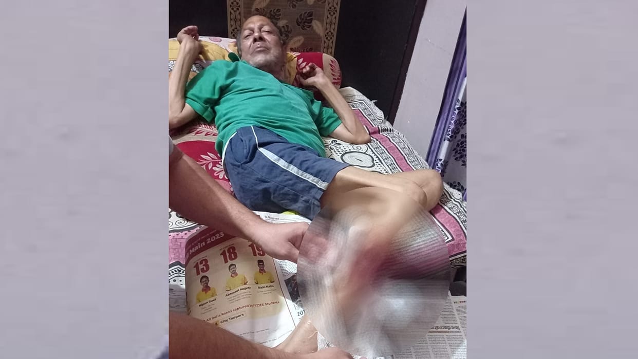 Dogs attacked on an elderly man in Ekta nagar Lucknow.