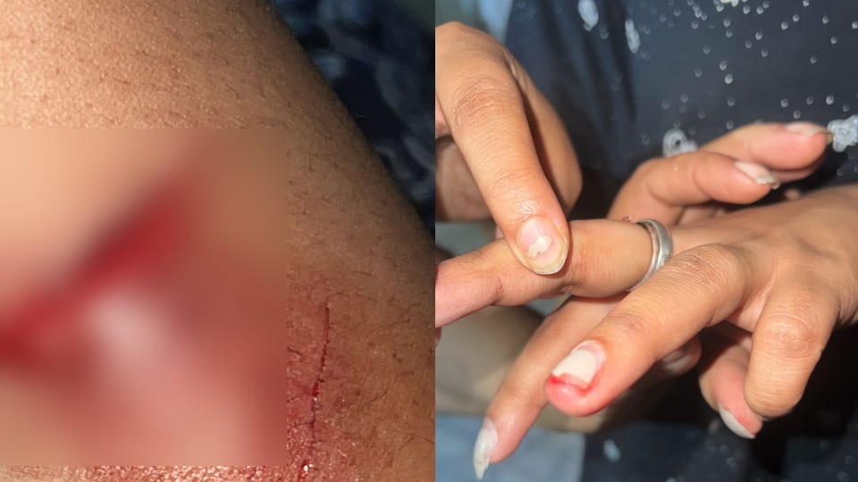 Boyfriend entered the house to meet his girlfriend, family members beat him with a stick, death, report on thr