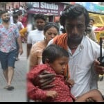 Agra News: ताजमहल के पास मासूम पर कुत्ते ने किया हमला, गंभीर रूप से जख्मी