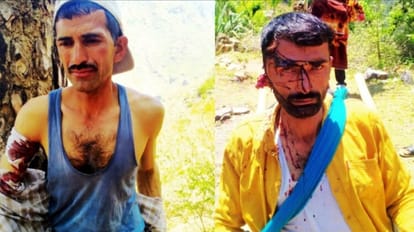 Bear attack: बच्चे पर झपटा तो पिता और पड़ोसी भिड़ गए भालू से, दोनों गंभीर घायल Himachal Mandi News: Two critically injured in sundernagar bear attack