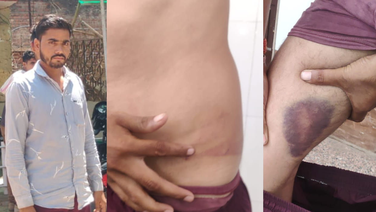 Police beat up a young man for complaining in CM Helpline in Morena, instructions for investigation after alle