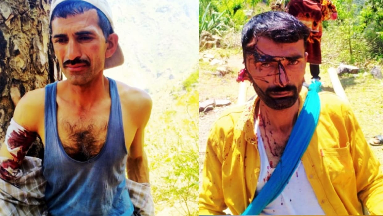 Himachal Mandi News: Two critically injured in sundernagar bear attack