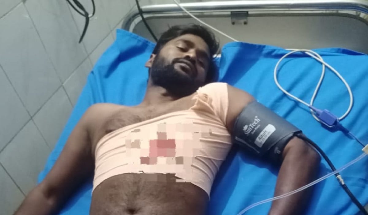 young man was shot and robbed of his bike in varanasi incident created stir on  Ring Road