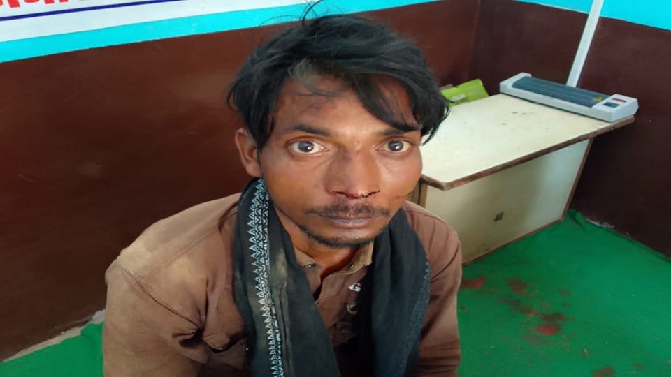 Friend accused of snatching money by beating