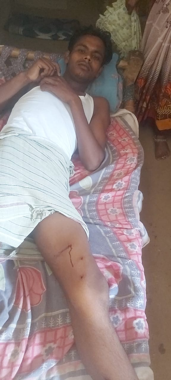 Bijnor: Guldar attacked a young man who was cutting fodder in the forest, injured, condition critical