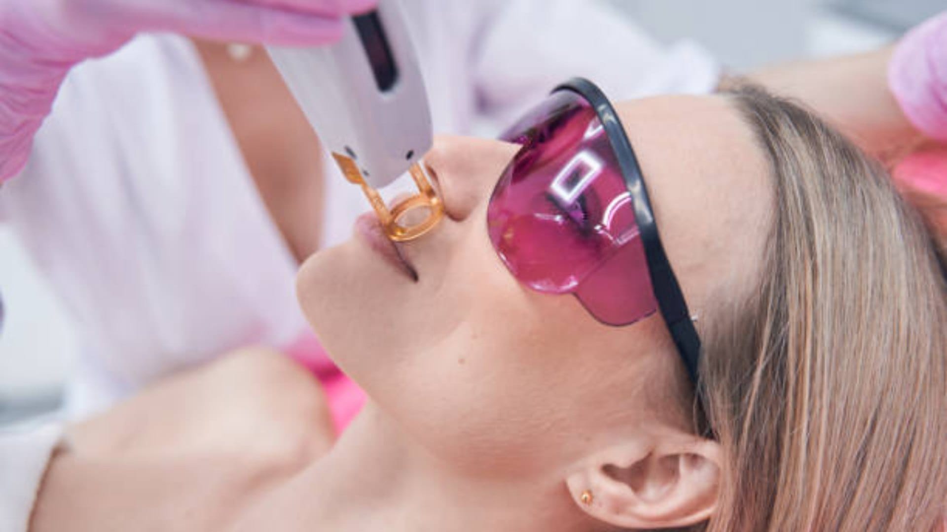Hair Removal Tips Know Easy Tips to Remove Upper Lips Hair at Home