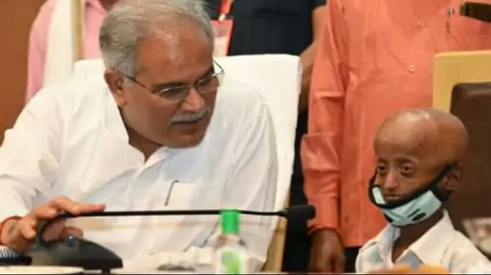 Chhattisgarh progeria victim and one day collector Shailendra Dhruv passed away in gariaband