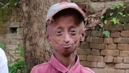 Chhattisgarh progeria victim and one day collector Shailendra Dhruv passed away in gariaband