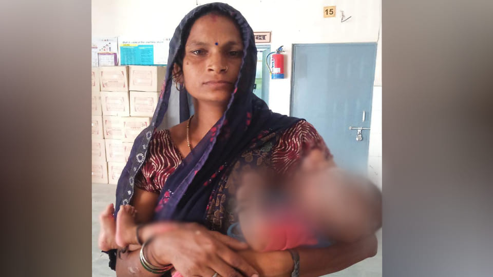 sisters sleeping below burnt alive due to fire in thatch in Agra condition of one remains critical