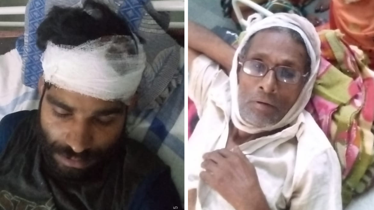 Sidhi: Bloody conflict between two sides over land dispute, attack with sharp weapon in front of police
