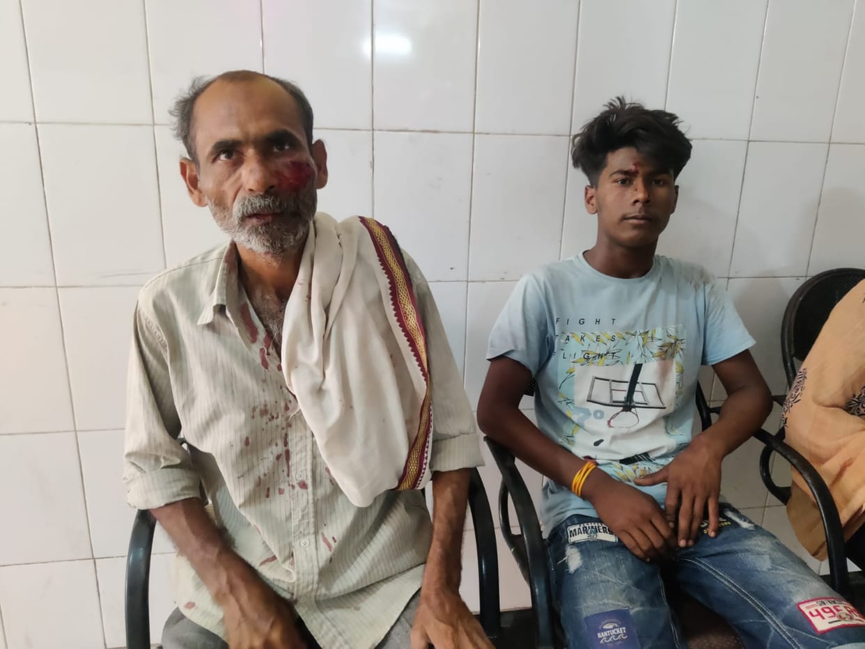 Bhadohi: Bloody struggle in Banjari village over obscene songs, lots of bricks and stones and sticks, many inj