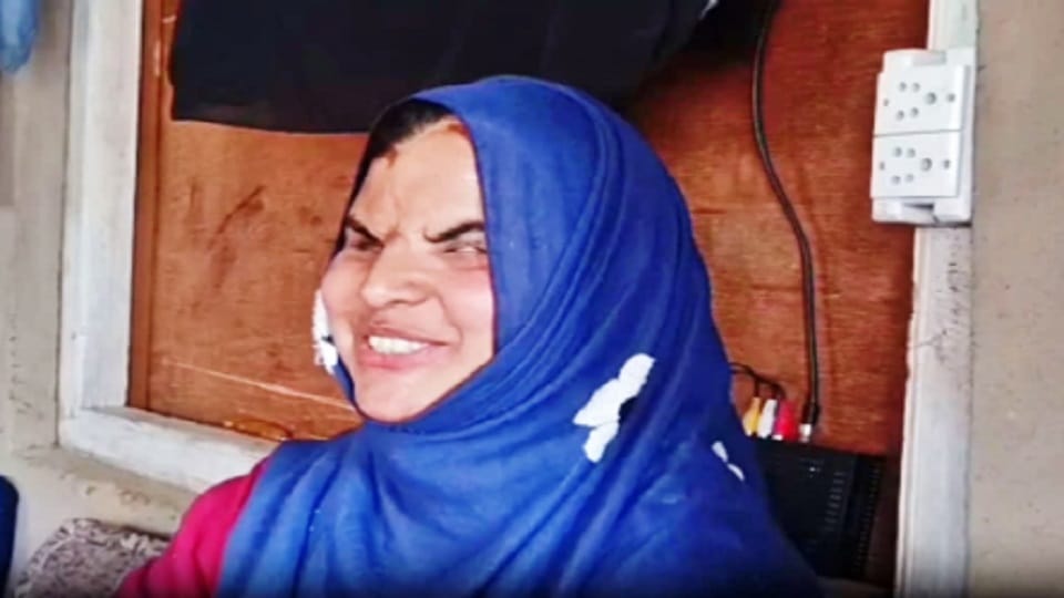 Srinagar: Pellet gun took away the light but Insha took flight of courage